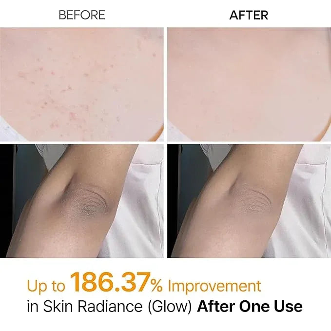 Dr.Melaxin Peel Shot: Kojic Acid Turmeric Exfoliating Spray