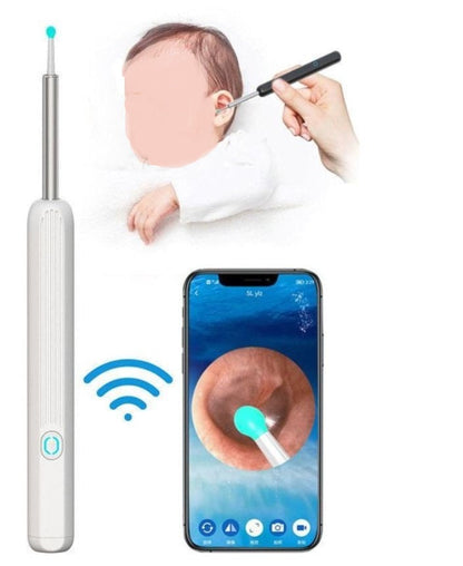 Smart Earwax Removal Kit 👂 HD Visual Ear Cleaner with Camera